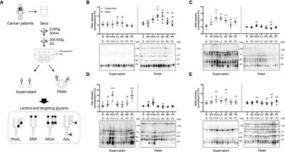 Terminal fucosylation of haptoglobin in cancer-derived exosomes during cholangiocarcinoma progression